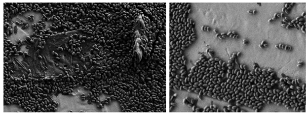 spores associated with debris (left) and spores in monolayer (right)