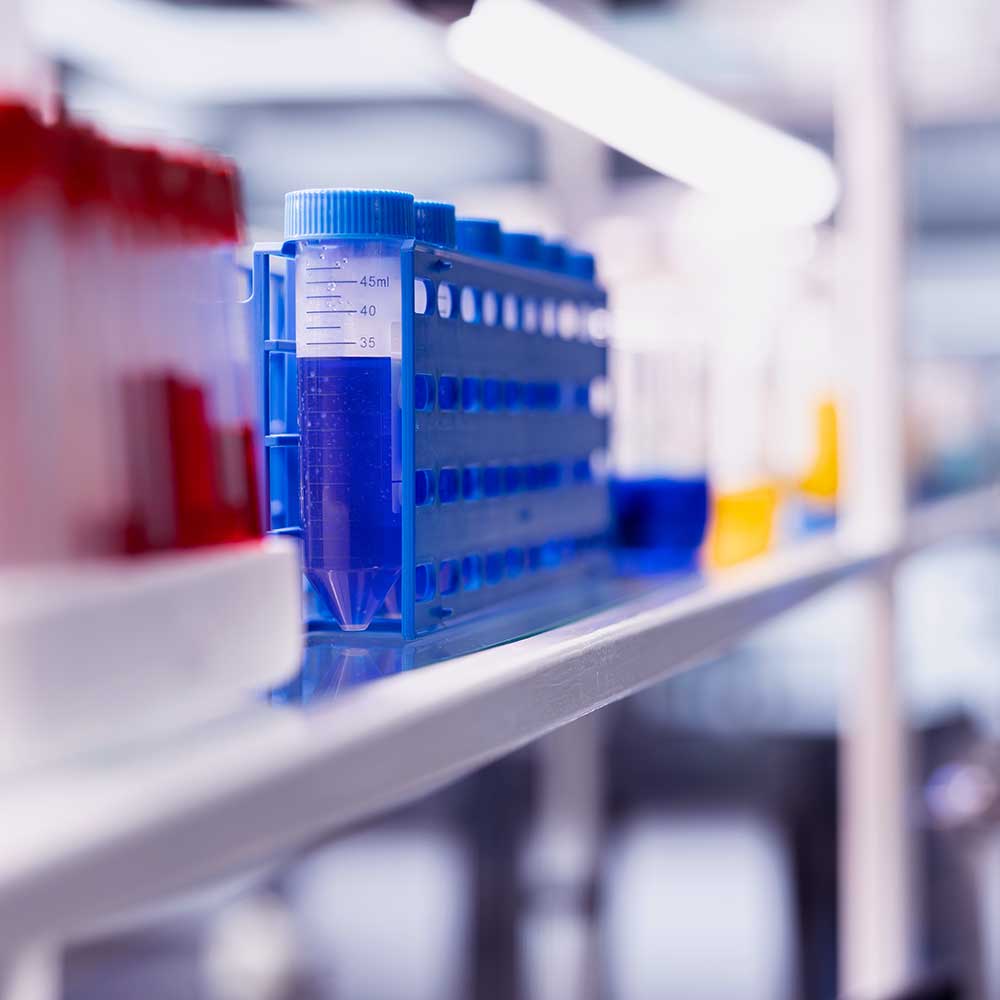 Standard versus Instant-SCBI for Steam Sterilization